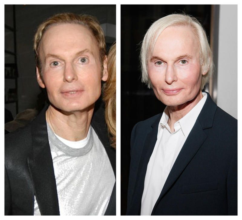Fredric Brandt – Unknown | Getty Images Photo by Marc Dimov/Patrick McMullan & Cindy Ord