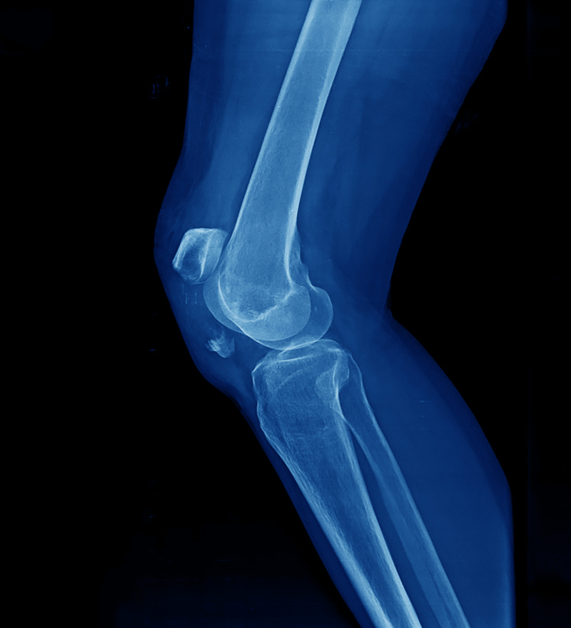 The Roundest Part of Your Body Is Your Kneecap | Shutterstock