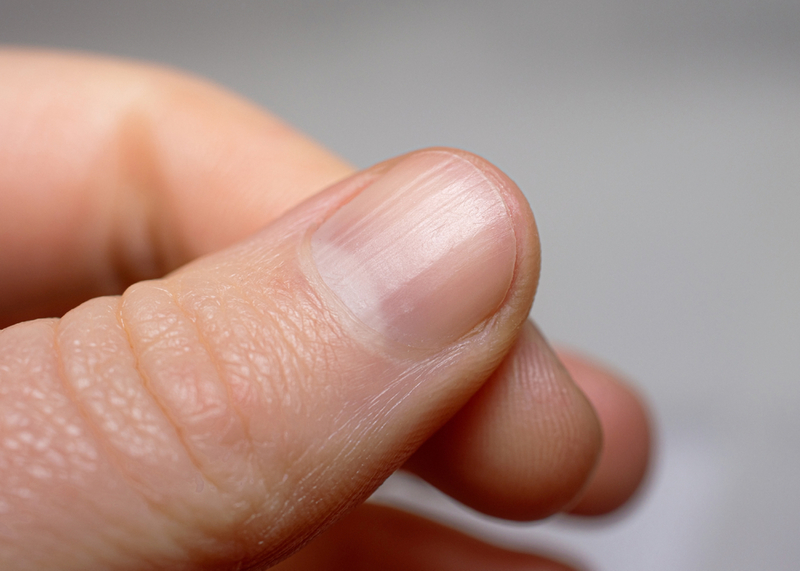 People’s Hair and Nails Continue to Grow Postmortem | Shutterstock