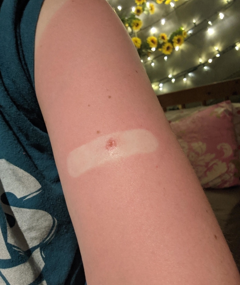 Quick, I Need More Band-Aids! | Reddit.com/LittleLightsintheSky